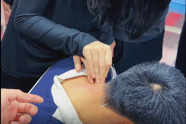 针灸班学员互相练习针刺